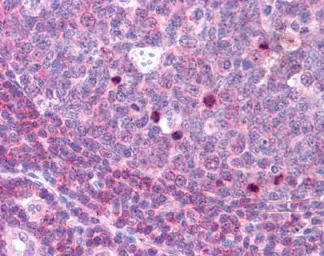 Aurora B (phospho Thr232) anti