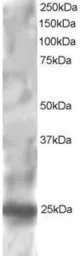 RGS1 antibody