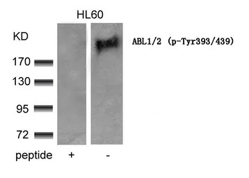 c-Abl (phospho Tyr412) antibod