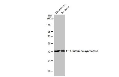 Glutamine synthetase antibody 