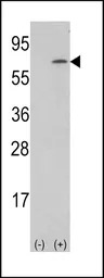 M-CSF antibody, Internal