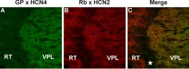 HCN2 antibody
