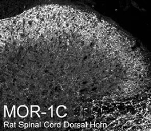 Mu Opioid receptor splice vari