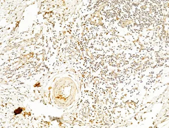 AMPK alpha 1 (phospho Thr183) 