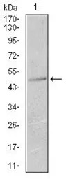 Cytokeratin 13 antibody [3G4]