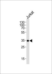 CD32a antibody, C-term