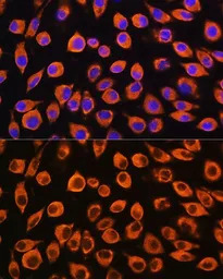 IL23 Receptor antibody