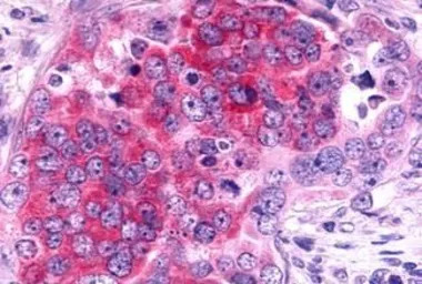 Trace Amine receptor 4 antibod