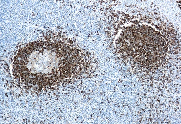 Hairy Cell Leukemia antibody [