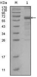 MSH6 antibody [3A10H7]