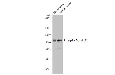 alpha Actinin 2 antibody [GT12