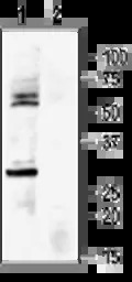 Kir6.1 antibody
