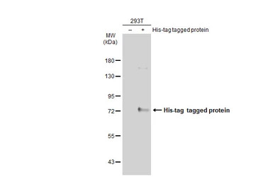 6X His tag antibody [GT359] (H