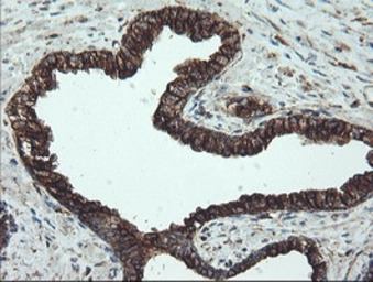 alpha Tubulin 8 antibody [2G6]