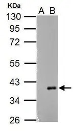ARPC1A antibody