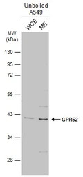 GPR52 antibody