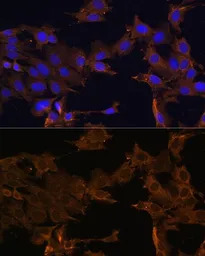 PDGF Receptor beta antibody