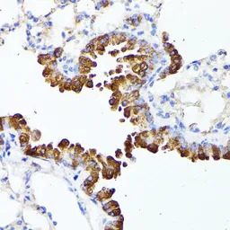 SMYD4 antibody