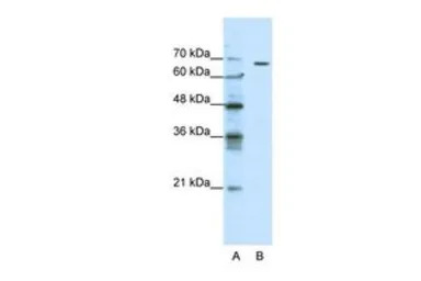 GABA A Receptor theta antibody