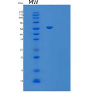 人巨噬细胞集落刺激因子1受体重组蛋白