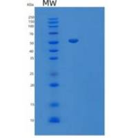 人巨噬细胞集落刺激因子1受体重组蛋白