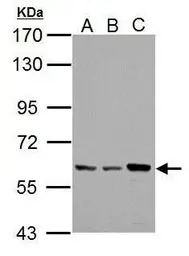 Pyruvate Kinase (liver/RBC) an