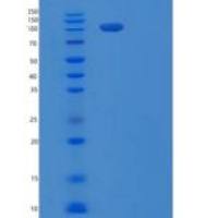 人整合素α-5/ITGA5重组蛋白C-6His