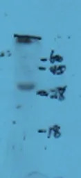 NKp44 antibody