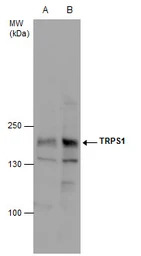 TRPS1 antibody