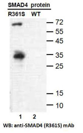 SMAD4 (R361S)