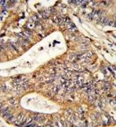 Calreticulin antibody, Interna