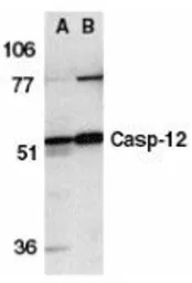 Caspase 12 antibody, N-term