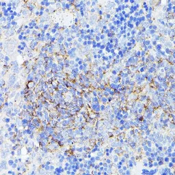 SMYD4 antibody