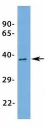 KCNK9 antibody, N-term