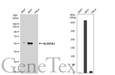 ALDH1A3 antibody [N2C2], Inter