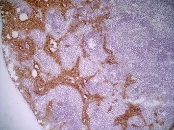 Marco antibody [ED31]