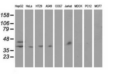 Haptoglobin antibody [4H5]