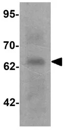 GRK6 antibody