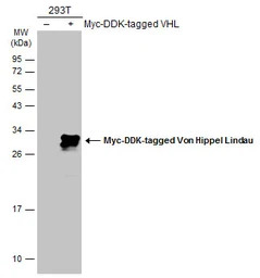 Von Hippel Lindau antibody