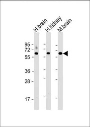 Glutaminase antibody, C-term