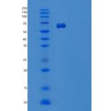 小鼠白细胞介素1受体1型/白细胞介素1R-1重组蛋白