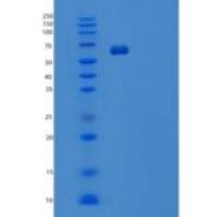 小鼠白细胞介素1受体1型/白细胞介素1R-1重组蛋白