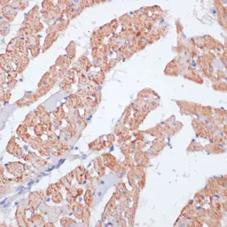 beta Arrestin 1 antibody