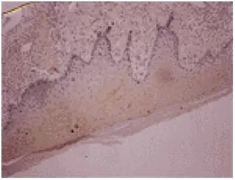 Osteocalcin antibody [OC4-30]