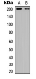 TSC2 (phospho Ser939) antibody