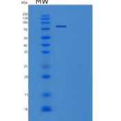 人髓过氧化物酶/MPO重组蛋白C-10His产品图
