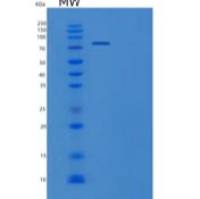 人髓过氧化物酶/MPO重组蛋白C-10His