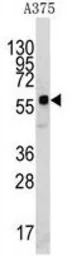 KREMEN1 antibody, N-term
