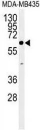 ERO1LB antibody