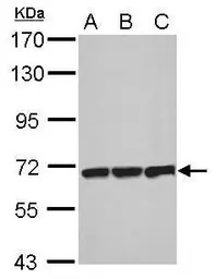 T-Plastin antibody